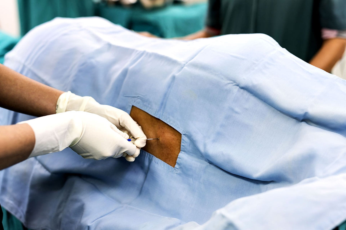 Epidurale durante il parto: tutto quello che devi sapere